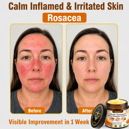 🔥 Upgrade To The Complete Anti-Aging System — 90% OFF Today  Get Face + Eye + Neck + Brightening Care In One Powerful Routine